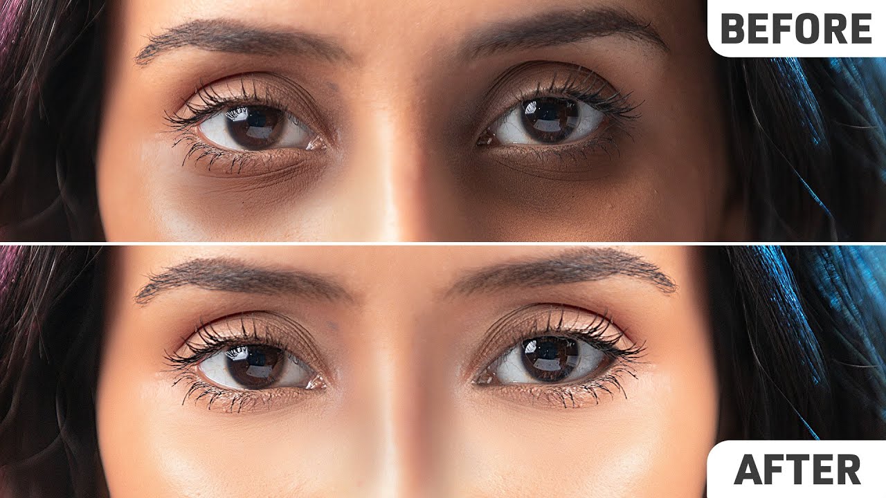 Cover dark circles with natural ingredients