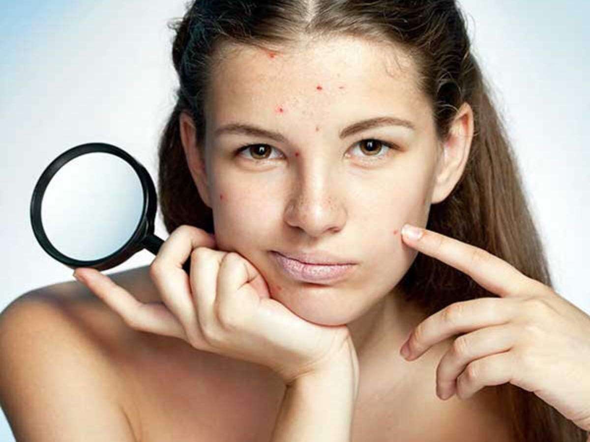 eliminate acne