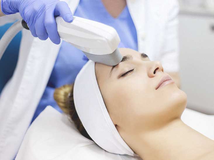 IPL_Treatment