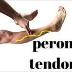Peroneal Tendonitis: Causes, Symptoms, and Treatment Options Peroneal Tendonitis