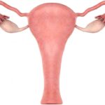 Understanding Enlarged Uterus: Causes, Symptoms, and Treatment Options causes of enlarged uterus