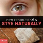 How to Get Rid of a Stye Overnight: Effective Remedies to Relieve Discomfort and Promote Healing how to get rid of a stye overnight