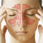 Are Sinus Infections Contagious? Understanding the Spread and Prevention are sinus infections contagious