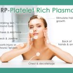 “The Magic of PRP Facial: Unlocking Radiant Skin and Youthful Glow” PRP Facial