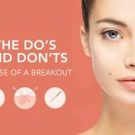 Mastering the Art of Pimple Popping: A Step-by-Step Guide for Clearer Skin how to pop a pimple