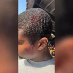 Ohio Amusement park guest hit by phone on 70mph roller coaster As a result, Carter said that the injury left an open head wound which bled for over an hour in addition to a diagnosed concussion. (David Carter)
