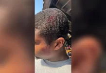 Ohio Amusement park guest hit by phone on 70mph roller coaster As a result, Carter said that the injury left an open head wound which bled for over an hour in addition to a diagnosed concussion. (David Carter)