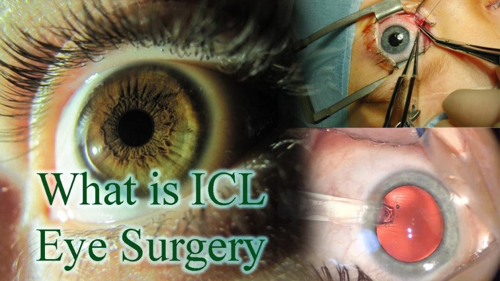 ICL surgery