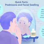 Understanding Moon Face: Causes, Symptoms, and Management of Facial Swelling Moon Face