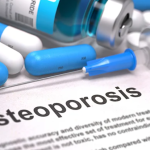 Reclast Side Effects: What You Need to Know Reclast Side Effects