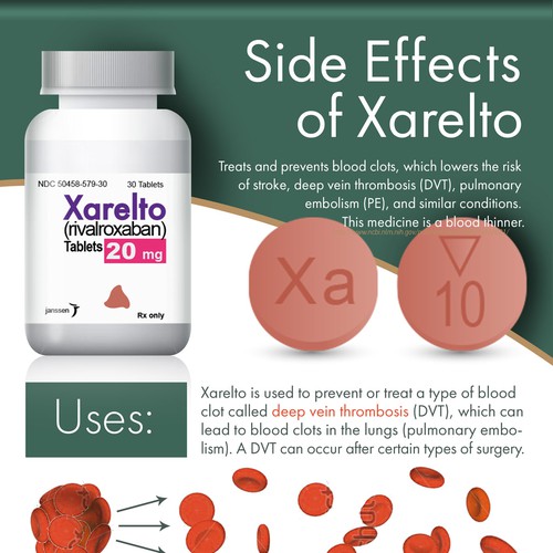 Xarelto Side Effects What You Need to Know