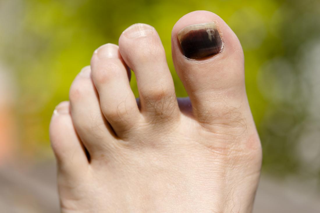 black to enail