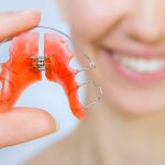 The Complete Guide to Cleaning Your Retainer: Tips for a Fresh and Healthy Smile cleaning a retainer