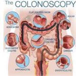 Finding Quality Colonoscopy Near Me: A Comprehensive Guide to Your Health colonoscopy near me