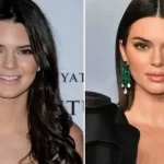 Bichectomia eboo therapy