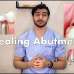 Healing Abutment: A Key to Successful Dental Implant Recovery Healing Abutment