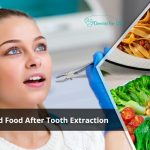 When Can I Eat Solid Food After Tooth Extraction