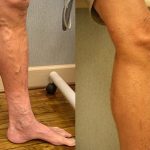 Dealing with Achy Legs: Causes, Remedies, and Prevention Tips achy legs