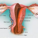 Decoding Adnexal Cysts: Causes, Symptoms, and Treatment Options adnexal cyst