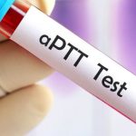 Mastering the APTT Test: Your Comprehensive Guide to Clotting Health Assessment aptt test