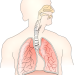Asthmatic Bronchitis: Symptoms, Causes, and Management asthmatic bronchitis
