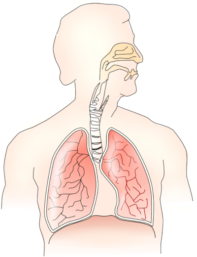asthmatic bronchitis
