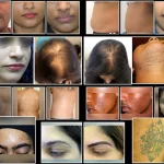 Your Guide to Finding the Best Dermatologist Near Me: Expert Skin Care at Your Fingertips best dermatologist near me