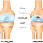 Ideal Path to Mobility: Unveiling the Best Joint Supplement best joint supplement