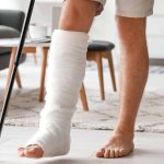 Managing a Broken Leg: From Injury to Healing broken leg