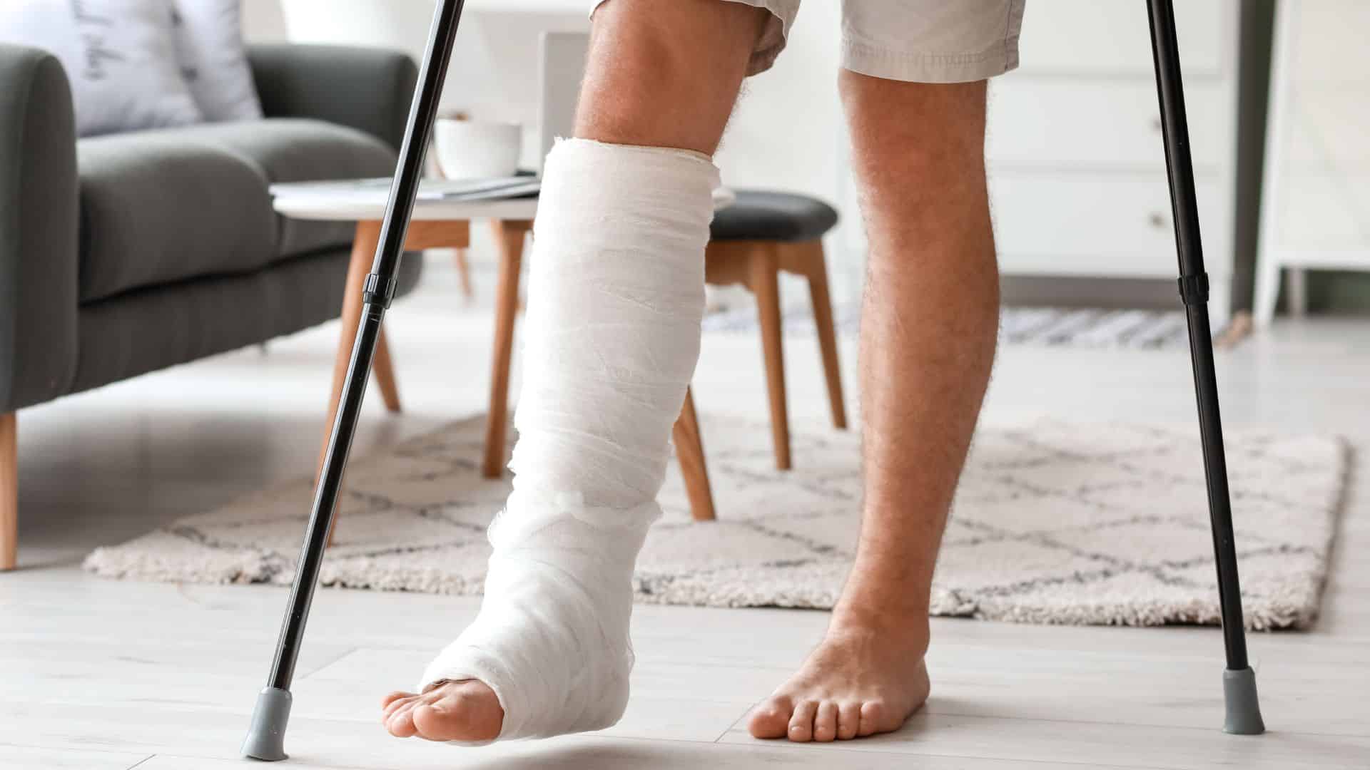 Managing a Broken Leg: From Injury to Healing