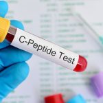 Demystifying C Peptide: Key Insights into Insulin, Diabetes, and Health c peptide