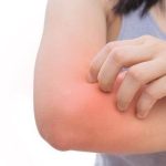 Say Goodbye to Chaffing: Causes, Prevention, and Remedies for Skin Irritation chaffing