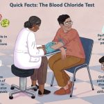 Chloride Blood Test: What You Need to Know chloride blood test