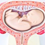Gastroschisis: Causes, Symptoms, Treatment, and Hope for Babies gastroschisis