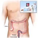 Finding a Trusted GI Doctor Near Me: Your Path to Digestive Health gi doctor near me