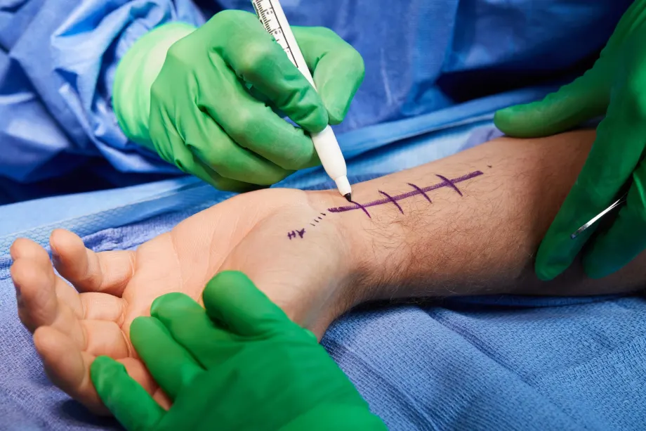 hand surgeon