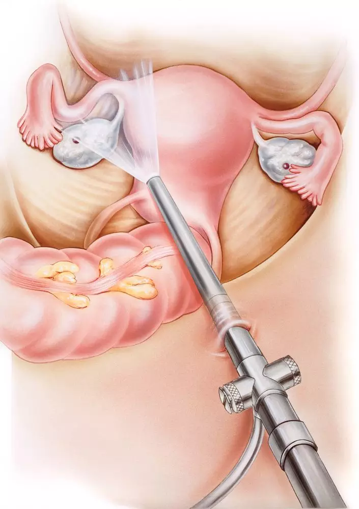 how long does a colonoscopy take