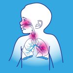 Is Croup Contagious? Exploring Transmission, Symptoms, and Risks” is croup contagious