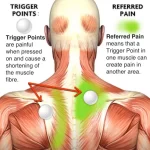 Mystery: Understanding and Relieving Knots in Back knots in back