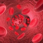Understanding Low MCH: Causes, Symptoms, and Treatment Options low mch