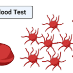 Decoding Low MPV Blood Test: Causes, Symptoms, and Management low mpv blood test