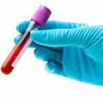 Decoding MCHC Blood Test Low Levels: Causes, Symptoms, and Treatment mchc blood test low