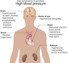 nifedipine side effects