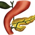 Understanding Pancreas Divisum: Causes, Symptoms, and Treatment Options pancreas divisum
