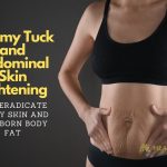 Panniculectomy: What You Need to Know About This Body Contouring Procedure panniculectomy