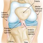 PCL Injury: Causes, Symptoms, and Treatment Options pcl injury
