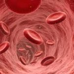Decoding PNH: Causes, Symptoms, and Management of Paroxysmal Nocturnal Hemoglobinuria pnh