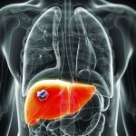 Demystifying Prealbumin: Functions, Tests, and Nutritional Insights prealbumin