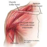 Treating a Pulled Muscle in the Chest pulled muscle in chest
