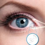 Enhancing Comfort and Relief: Exploring the Benefits of Punctal Plugs punctal plugs